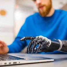 Upper extremity prosthetic hand