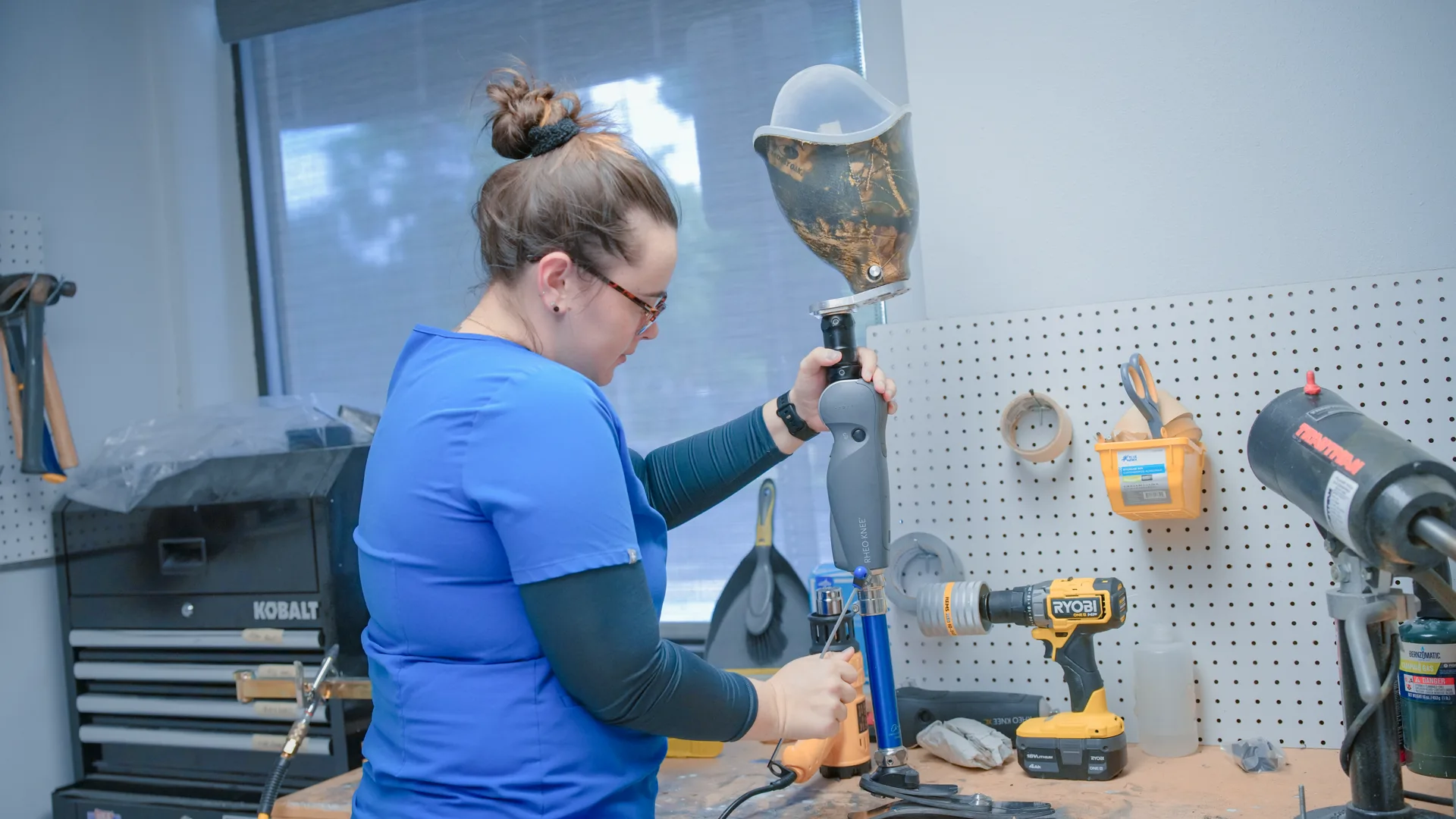 Proactive prosthetic monitoring